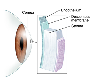 Side view of eye with inset showing layers of cornea.